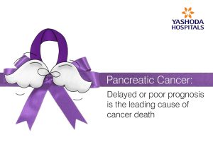 Pancreatic Cancer