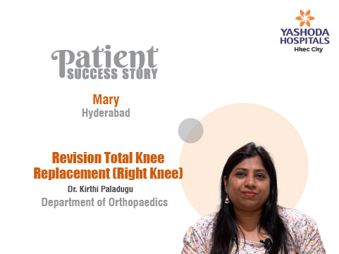 Revision Total Knee Replacement (Right Knee)