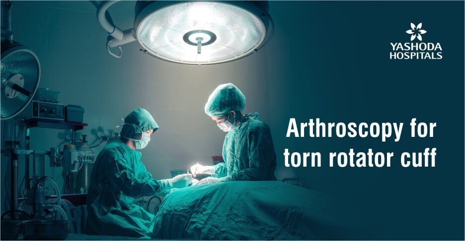 Arthroscopy for torn rotator cuff