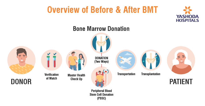 Bone Marrow Transplant (BMT)_Body 3