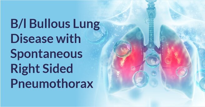 Bullous Lung Disease with Spontaneous Right Sided Pneumothorax