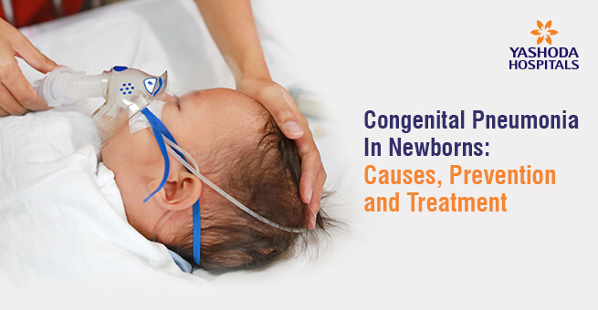 Congenital Pneumonia In Newborns