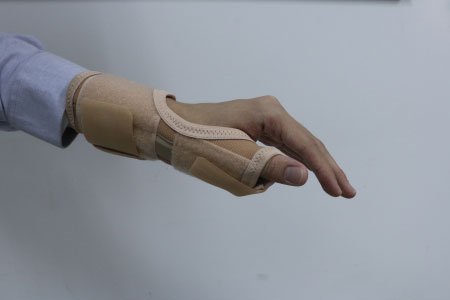 De Quervain Tenosynovitis Treatment