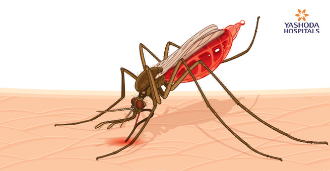 Dengue