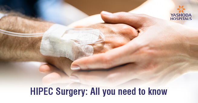 HIPEC Surgery