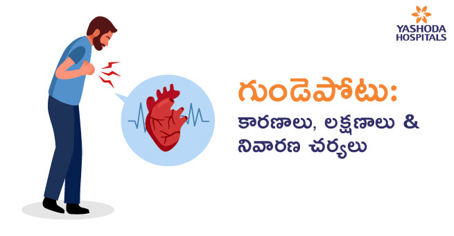 Heart Attack Causes, Symptoms & Preventive Measure