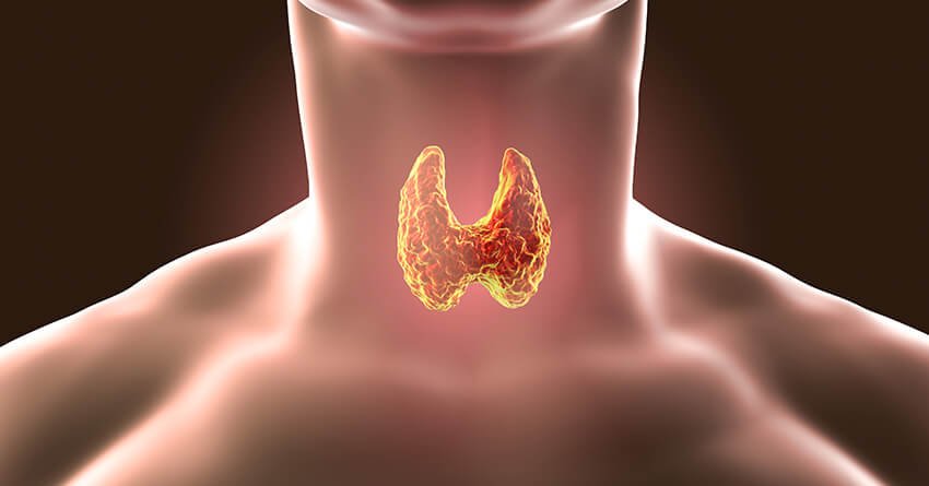 Hypothyroidism-common disorder