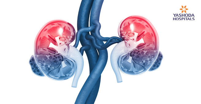 Kidney Disease