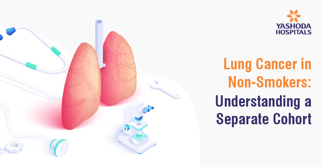 Lung Cancer in Non-Smokers: Understanding a Separate Cohort