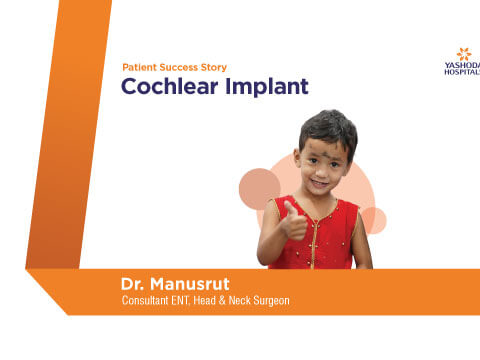 Cochlear Implantation