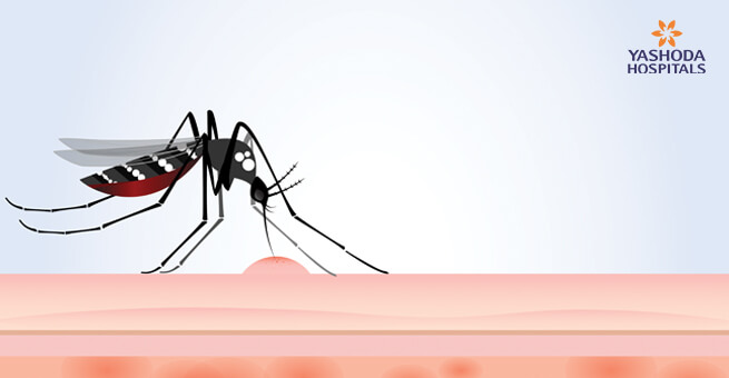 Malaria