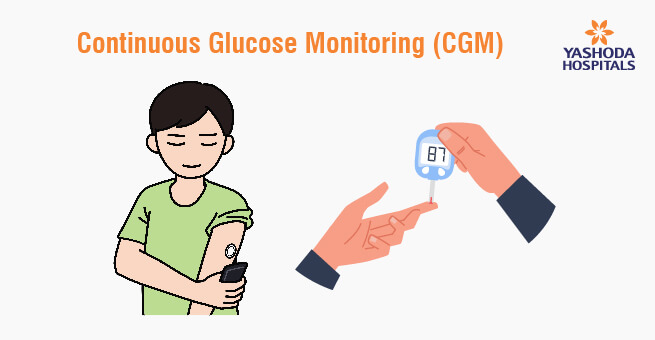 Managing Diabetes with Insulin Pumps