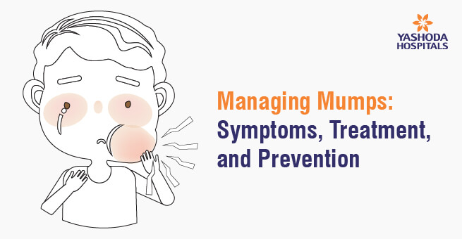 Managing Mumps banner