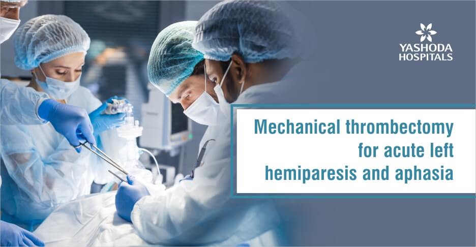 Mechanical thrombectomy