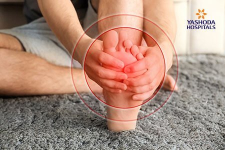 Morton's Neuroma: Symptoms and Complications