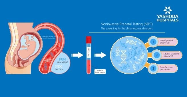 Non-invasive prenatal testing (NIPT)