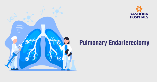 Pulmonary Endarterectomy