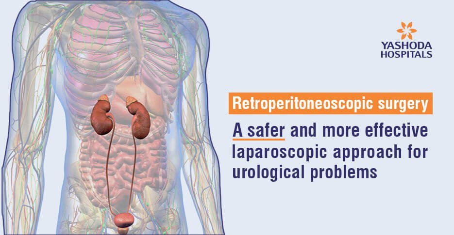 Retroperitoneoscopic surgery