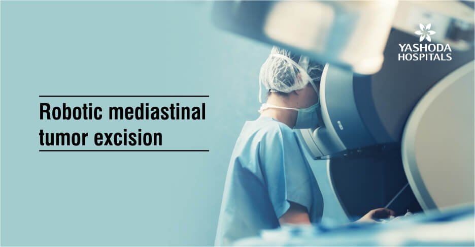 Robotic mediastinal tumor excision