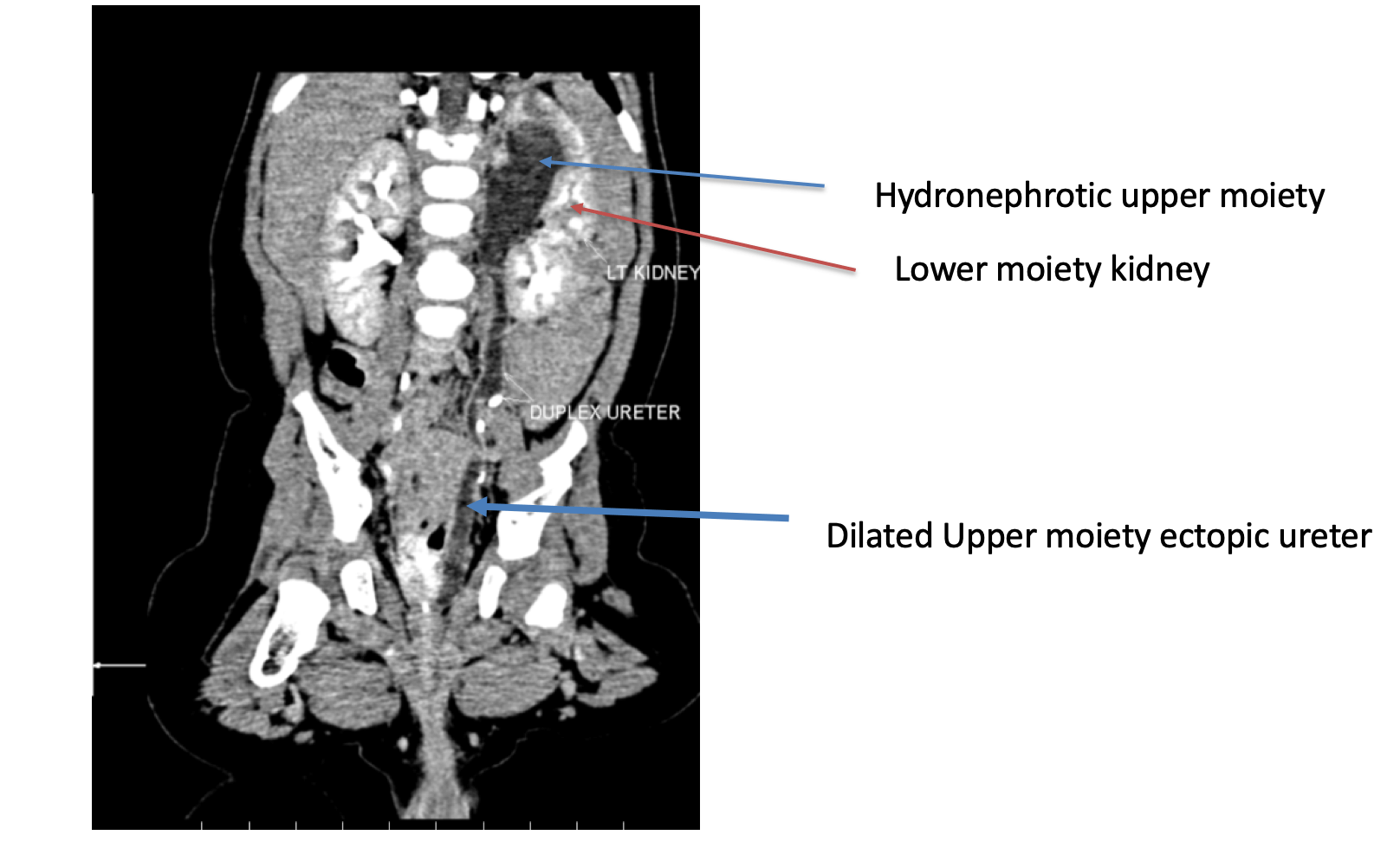 Robotic surgery CT UROGRAM