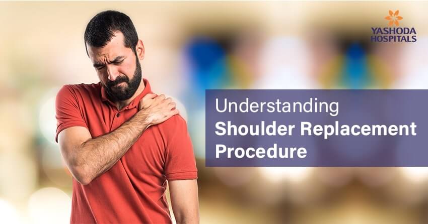 Shoulder Replacement Surgery (Arthroplasty)