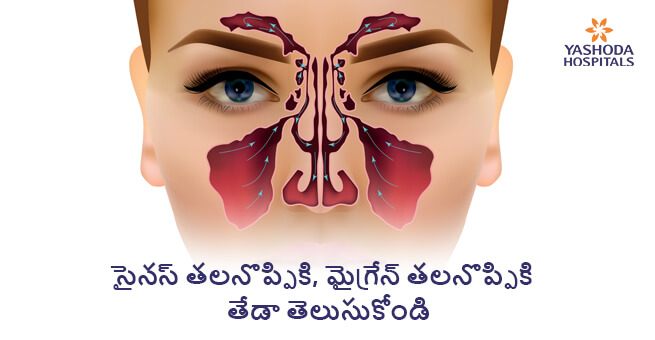 Sinus Congestion or Headache