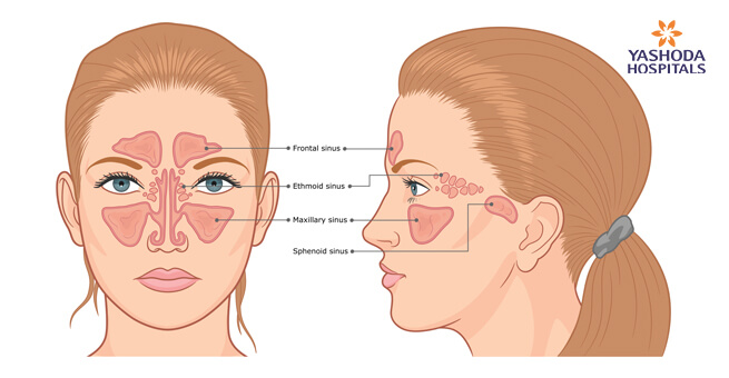 Sinus Congestion