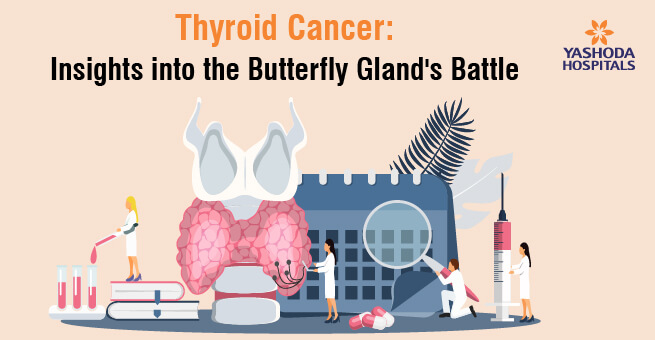 Thyroid Cancer