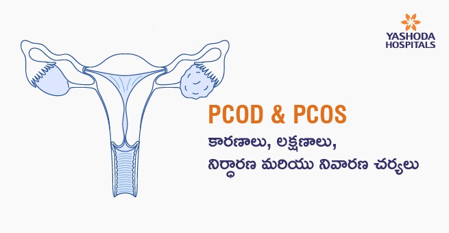 pcos/pcod treatment