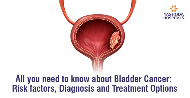 bladder cancer