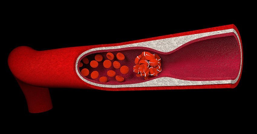 blood-coagulation system