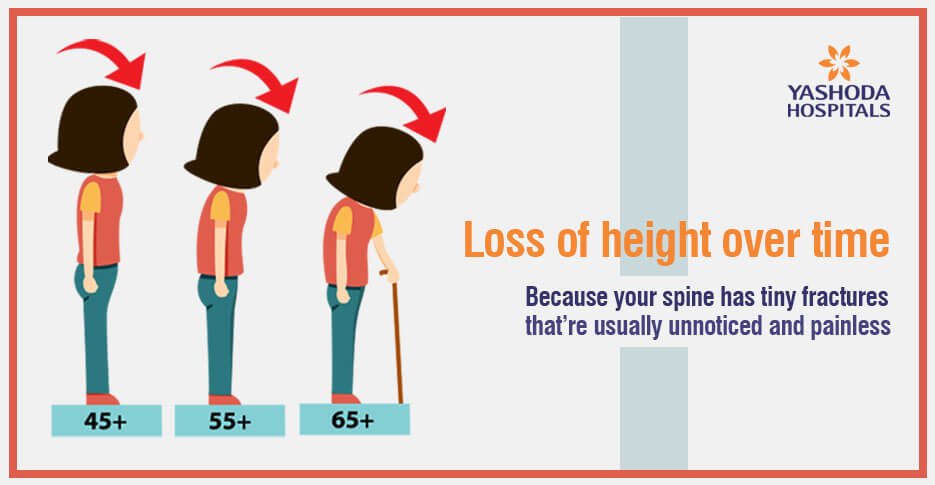 elderly related to osteoporosis