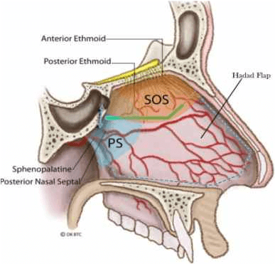 Pituitary Surgery