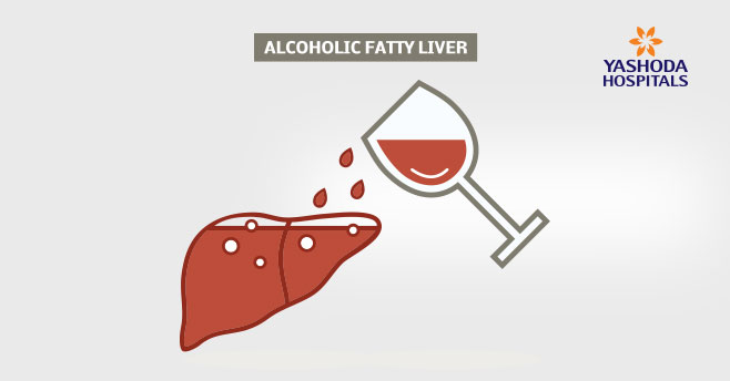 Liver Deseases