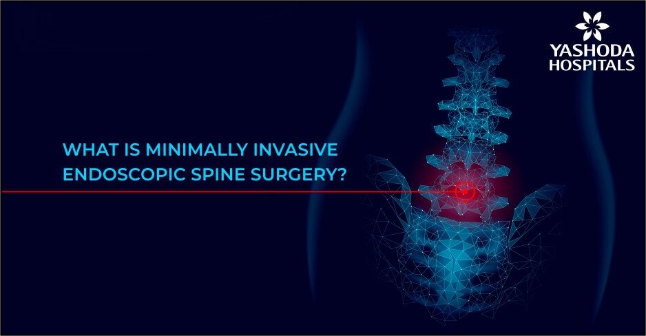 minimally invasive spine surgery - endoscopic spine surgery