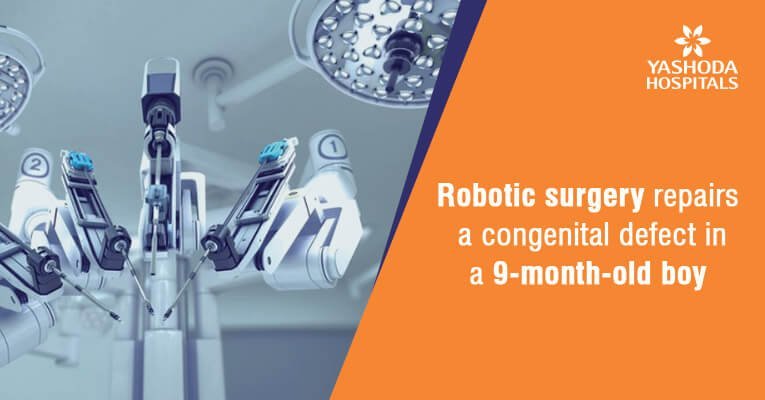 Robotic surgery repairs duplex kidney and ectopic ureter