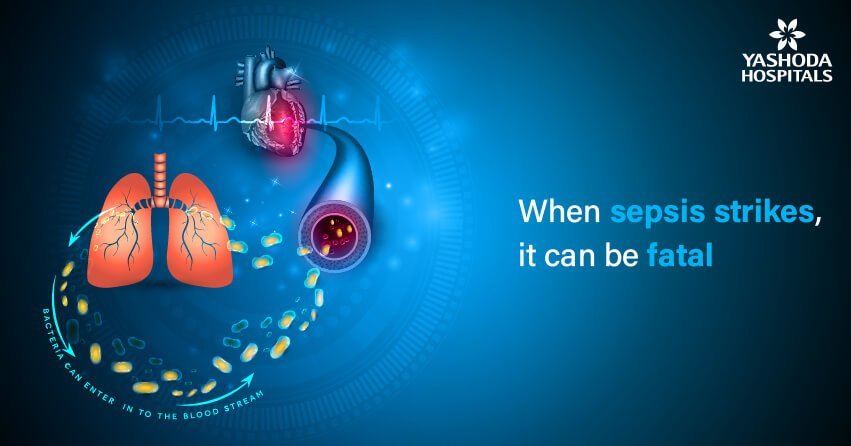 Is sepsis always life-threatening