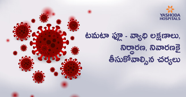 Tomato Flu Telugu ట‌మటా ఫ్లూ