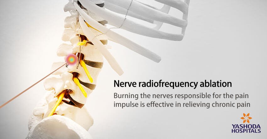 What are the treatment options for facet joint arthropathy