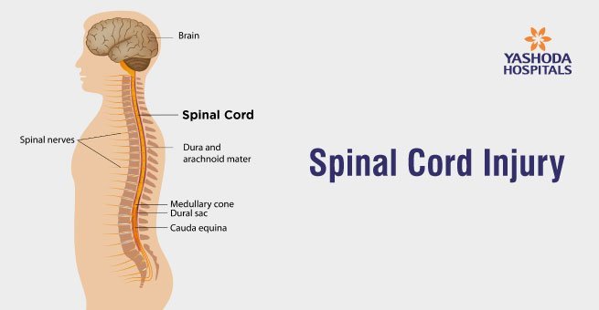 Spinal Cord Injury