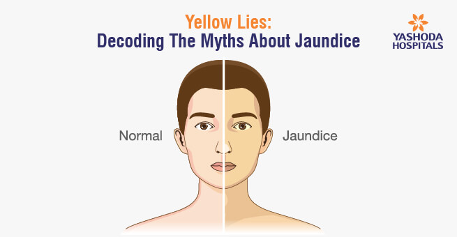 yellow-lies-banner